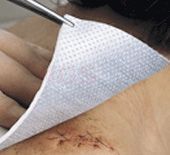 Metalline steriel nonwoven kompres 8 cm x 10 cm - per stuk