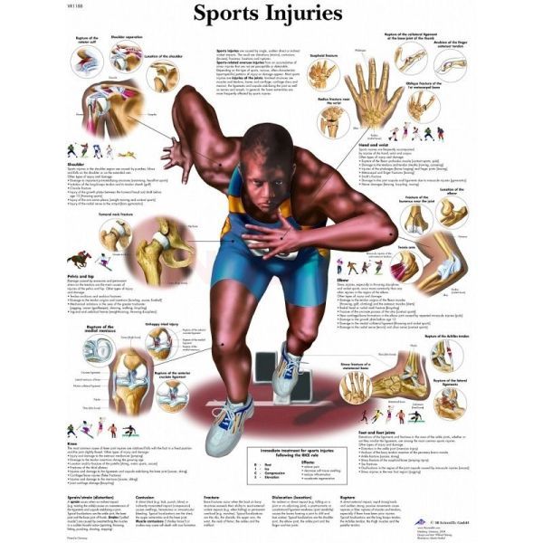 Anatomie poster Sports Injuries - sportblessures